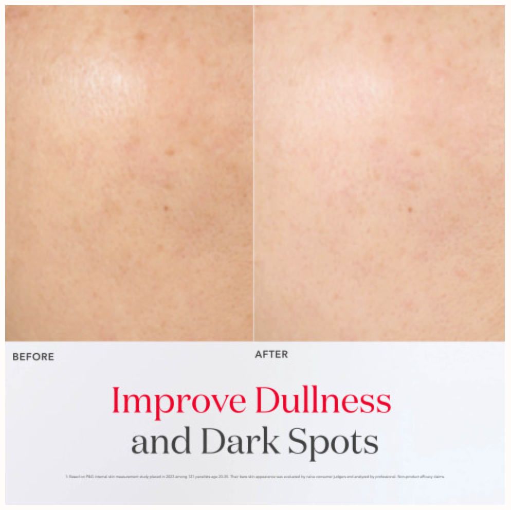 Brightening Serum  GenOptics InfinitAura Serum