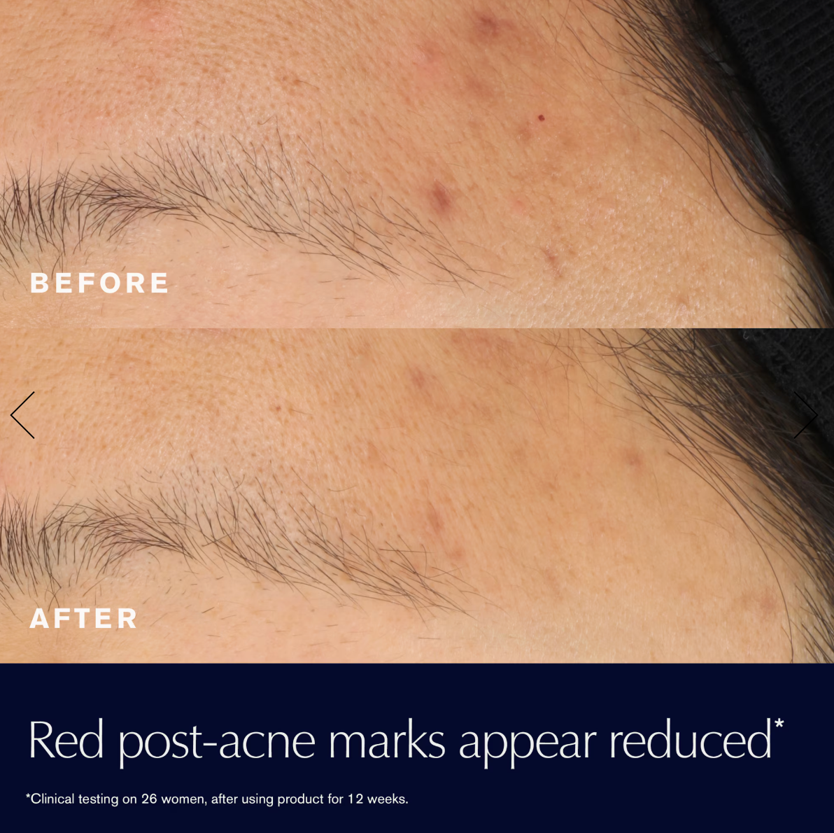 Advanced Night Repair Rescue Solution Serum with 15% Bifidus Ferment