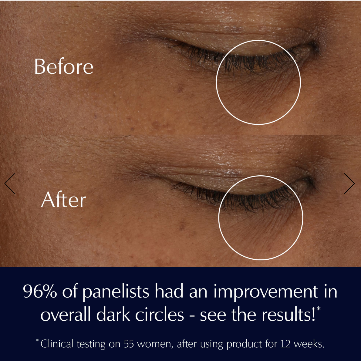 Advanced Night Repair Eye Supercharged Gel-Creme Synchronized Multi-Recovery Eye Cream