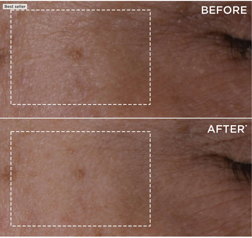 DOUBLE SERUM® - Anti-Aging + Anti-Wrinkle Serum
