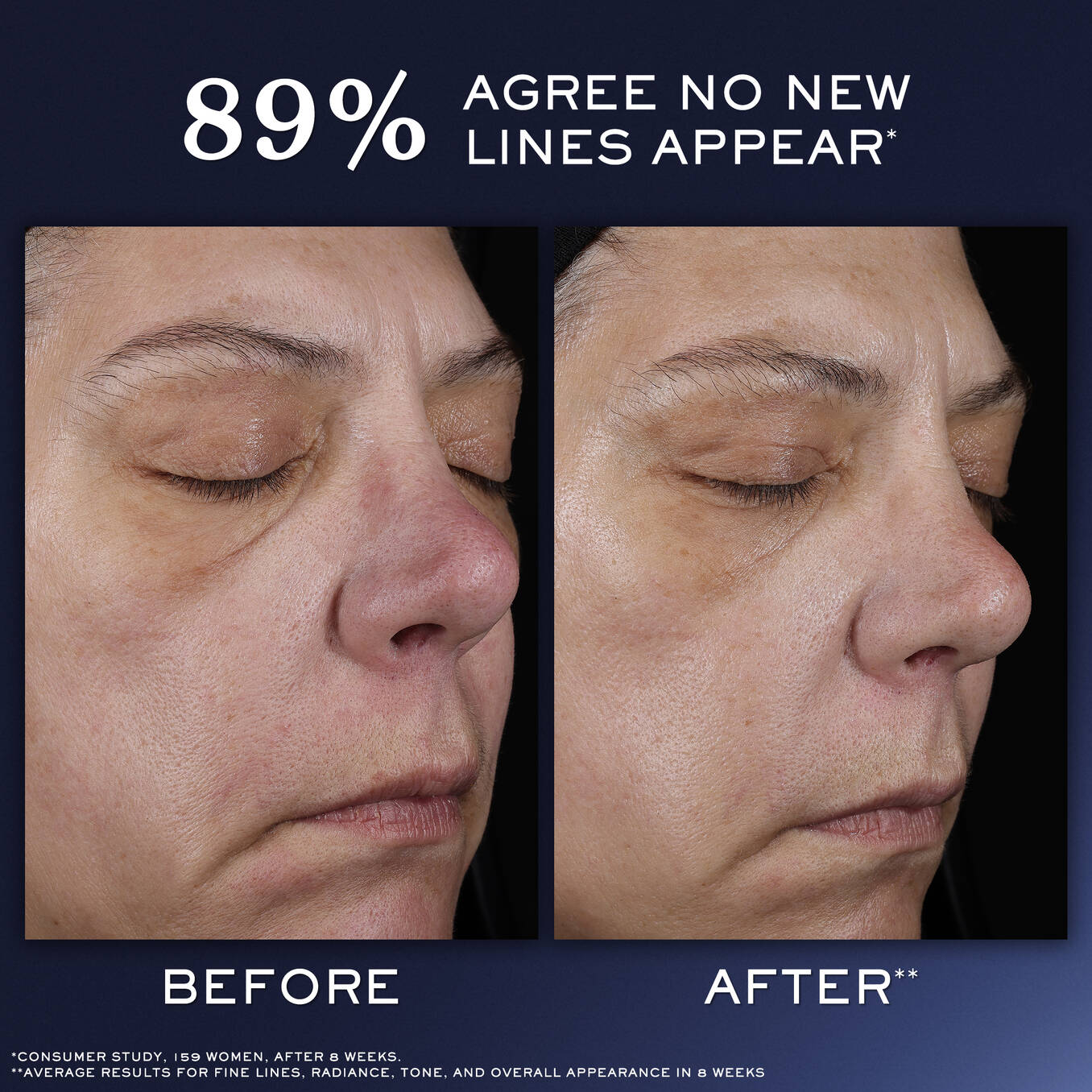 Génifique Ultimate Recovery Serum