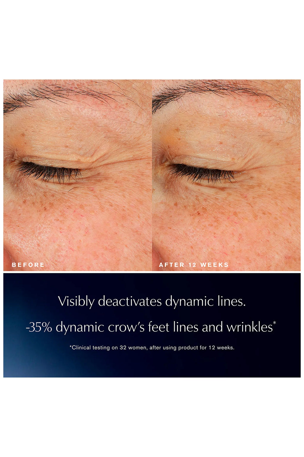 Advanced Night Repair Eye Lift + Sculpt Eye Cream