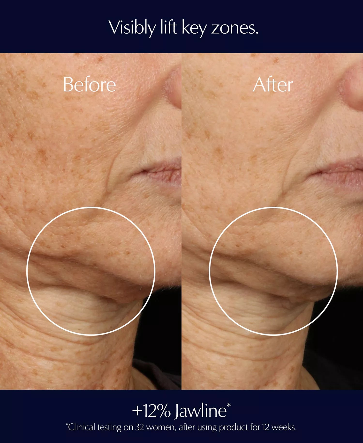 Perfectionist Pro Rapid Firm + Lift Serum with Hexapeptides 8 + 9