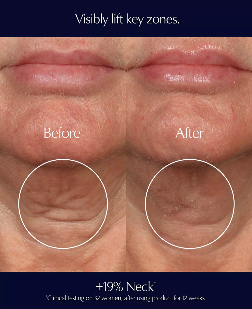 Perfectionist Pro Rapid Firm + Lift Serum with Hexapeptides 8 + 9