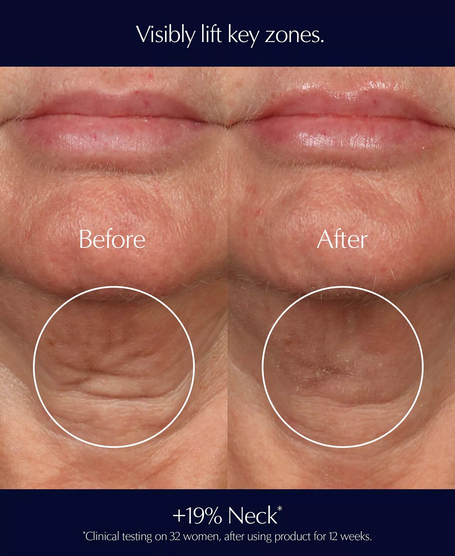 Perfectionist Pro Rapid Firm + Lift Serum with Hexapeptides 8 + 9