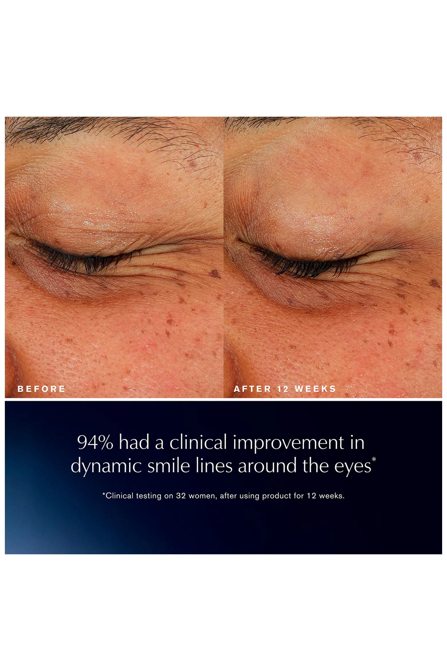 Advanced Night Repair Eye Lift + Sculpt Eye Cream