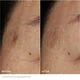 Bright Plus [Advanced] Serum - Brightening+ Dark Spot Targeting Serum