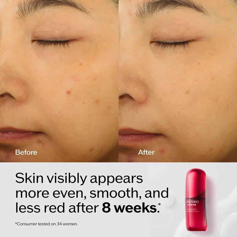 Ultimune Power Infusing Serum