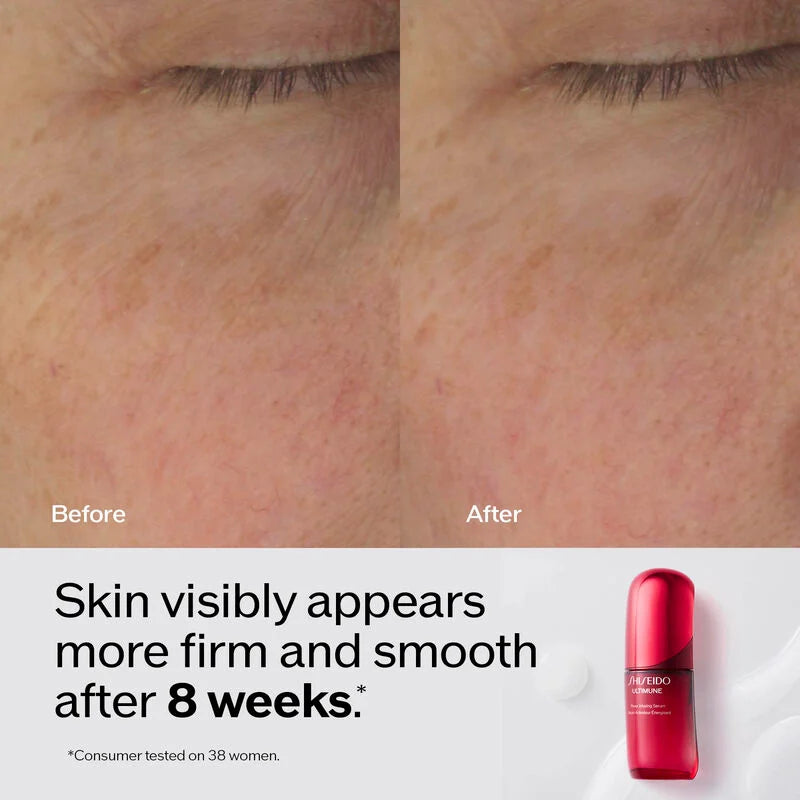 Ultimune Power Infusing Serum