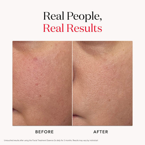 PITERA™ Facial Treatment Essence