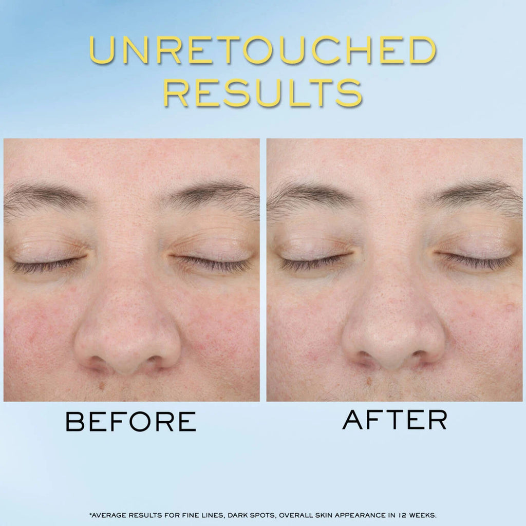 Supra Screen Invisible Serum Sunscreen SPF 50+