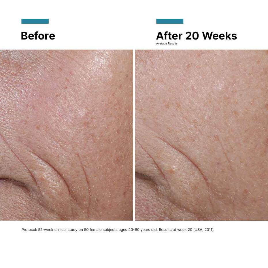 C E Ferulic® with 15% L-Ascorbic Acid