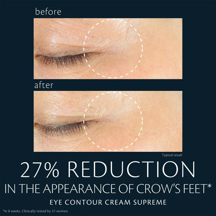 Eye Contour Cream Supreme