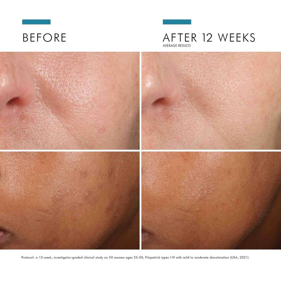 Phloretin CF with Ferulic Acid