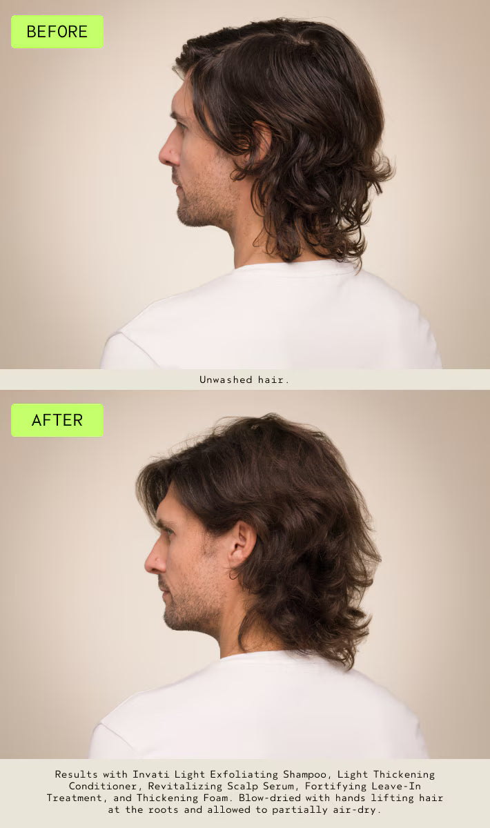 invati ultra advanced™ revitalizing scalp serum